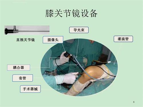 關節(jié)鏡下無源手術器械產品注冊審查指導原則（2021年第102號）(圖1)