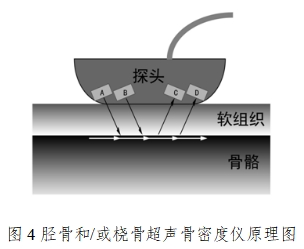 超聲骨密度儀注冊技術審查指導原則（2017年第180號）(圖4)