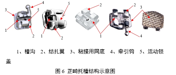 正畸托槽注冊審查指導(dǎo)原則（2022年第41號）(圖6)