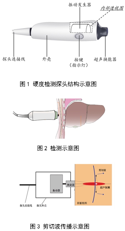 定量剪切波超聲肝臟測量儀注冊審查指導(dǎo)原則（2023年第7號）(圖2)