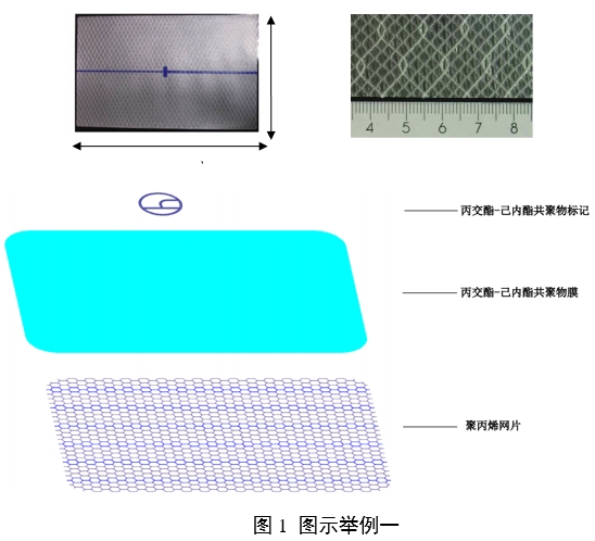 疝修補(bǔ)補(bǔ)片注冊(cè)審查指導(dǎo)原則（2023年修訂版）（2023年第9號(hào)）(圖4)