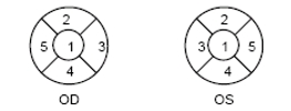 接觸鏡護(hù)理產(chǎn)品注冊(cè)審查指導(dǎo)原則（2023年修訂版）（2023年第9號(hào)）(圖15)